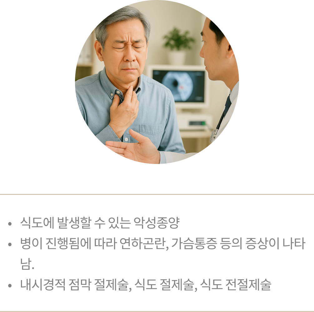 암 img 05.png
